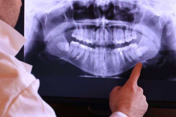 Best Emergency Tooth Extraction in Aurora, TX