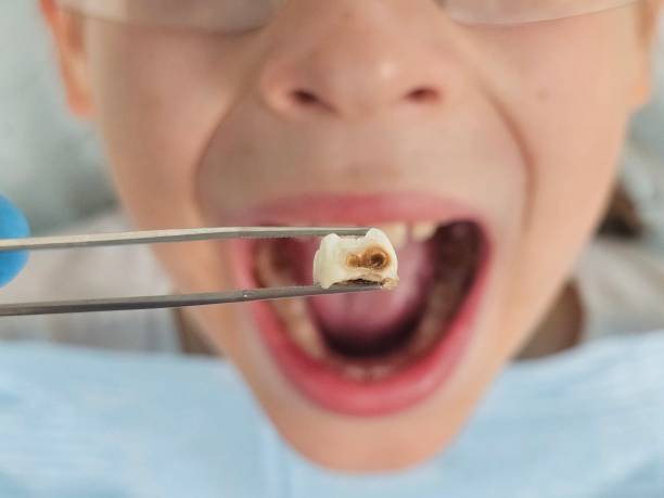 Best Weekend Emergency Dentist in Aurora, TX